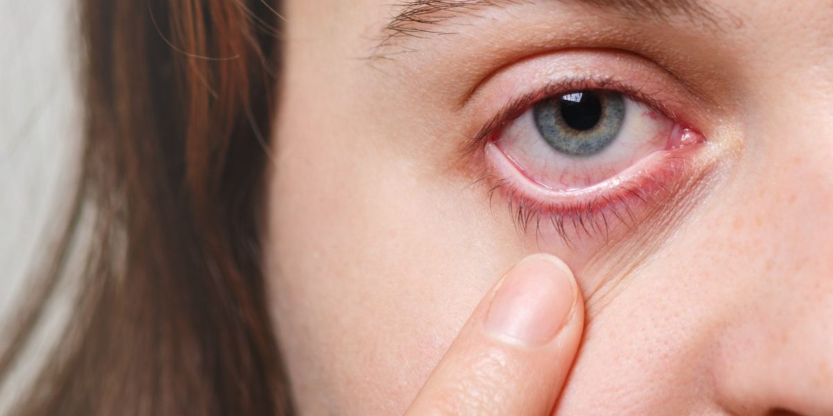 Diabetes And Eyes