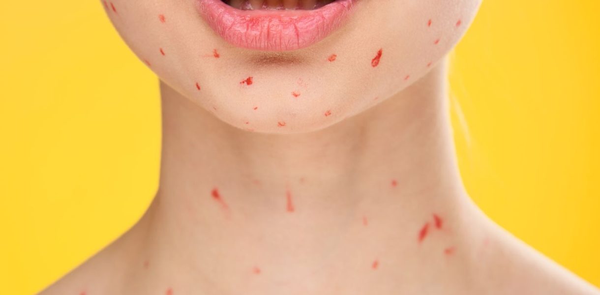 red bumps on your neck