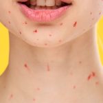 red bumps on your neck