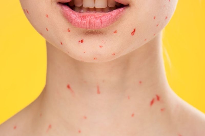 red bumps on your neck