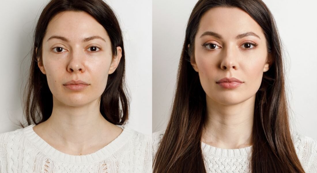 How to Lose Face Fat (Without Extreme Diets or Unrealistic Hacks)