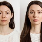How to Lose Face Fat (Without Extreme Diets or Unrealistic Hacks)