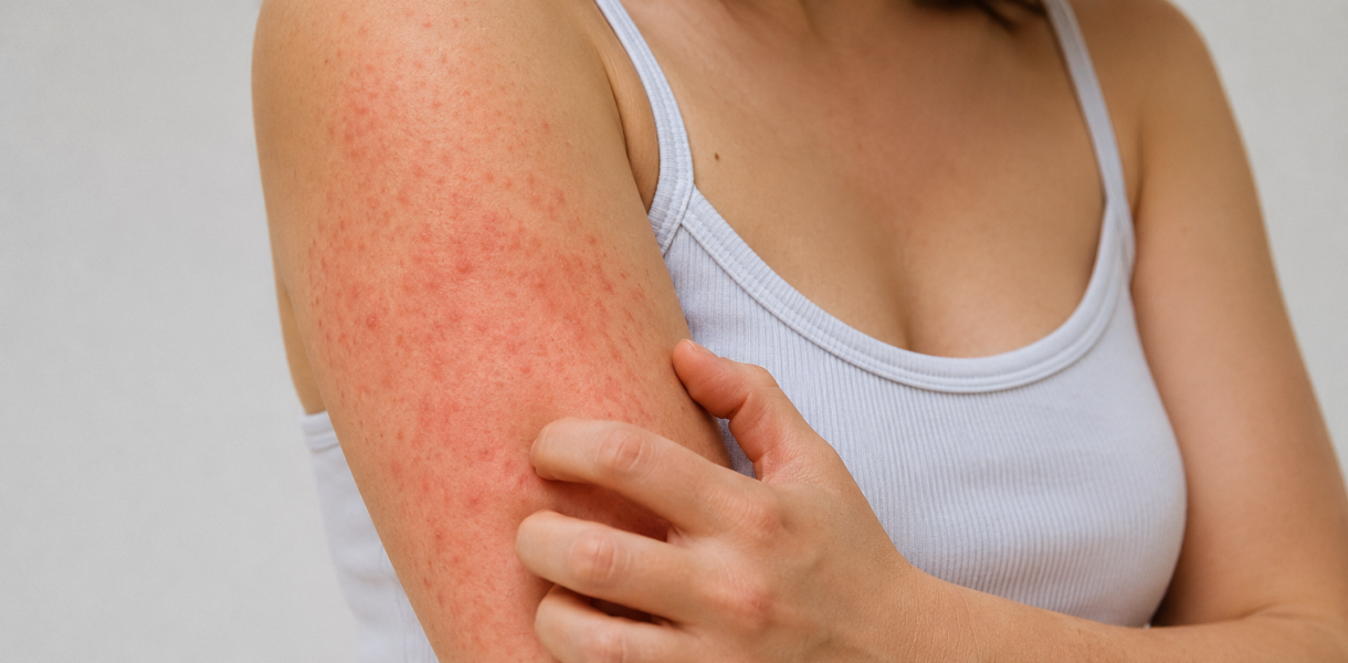 Skin Rashes Pictures, Causes, Symptoms and Treatment Guide