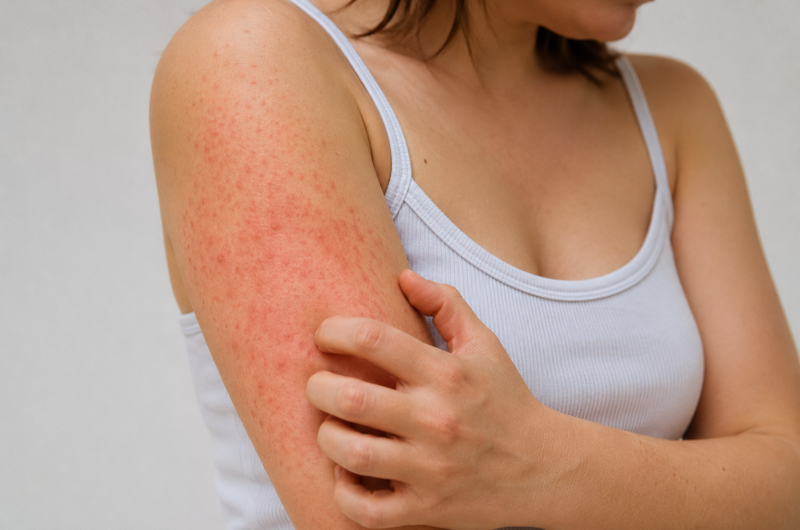 Skin Rashes Pictures, Causes, Symptoms and Treatment Guide